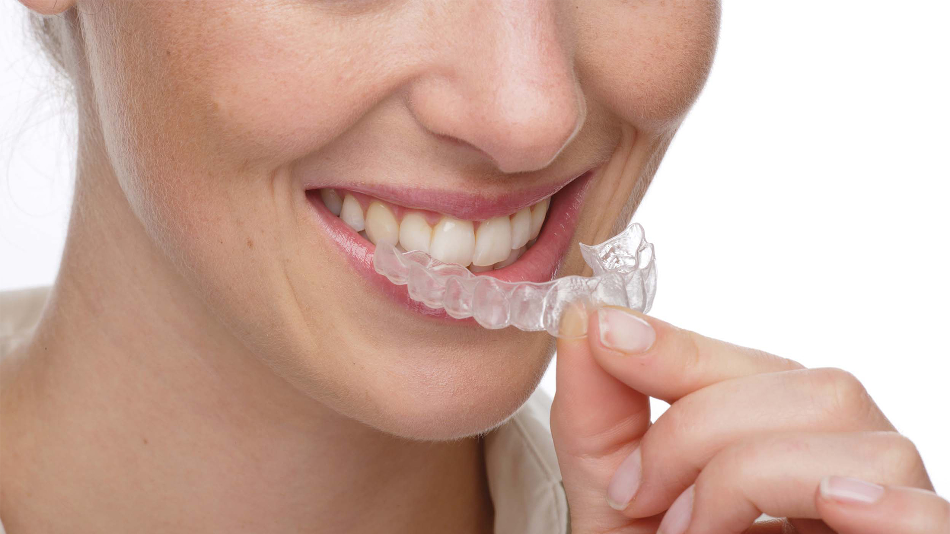 Invisalign: la ortodoncia más revolucionaria en la Clínica Dental Cuadrado