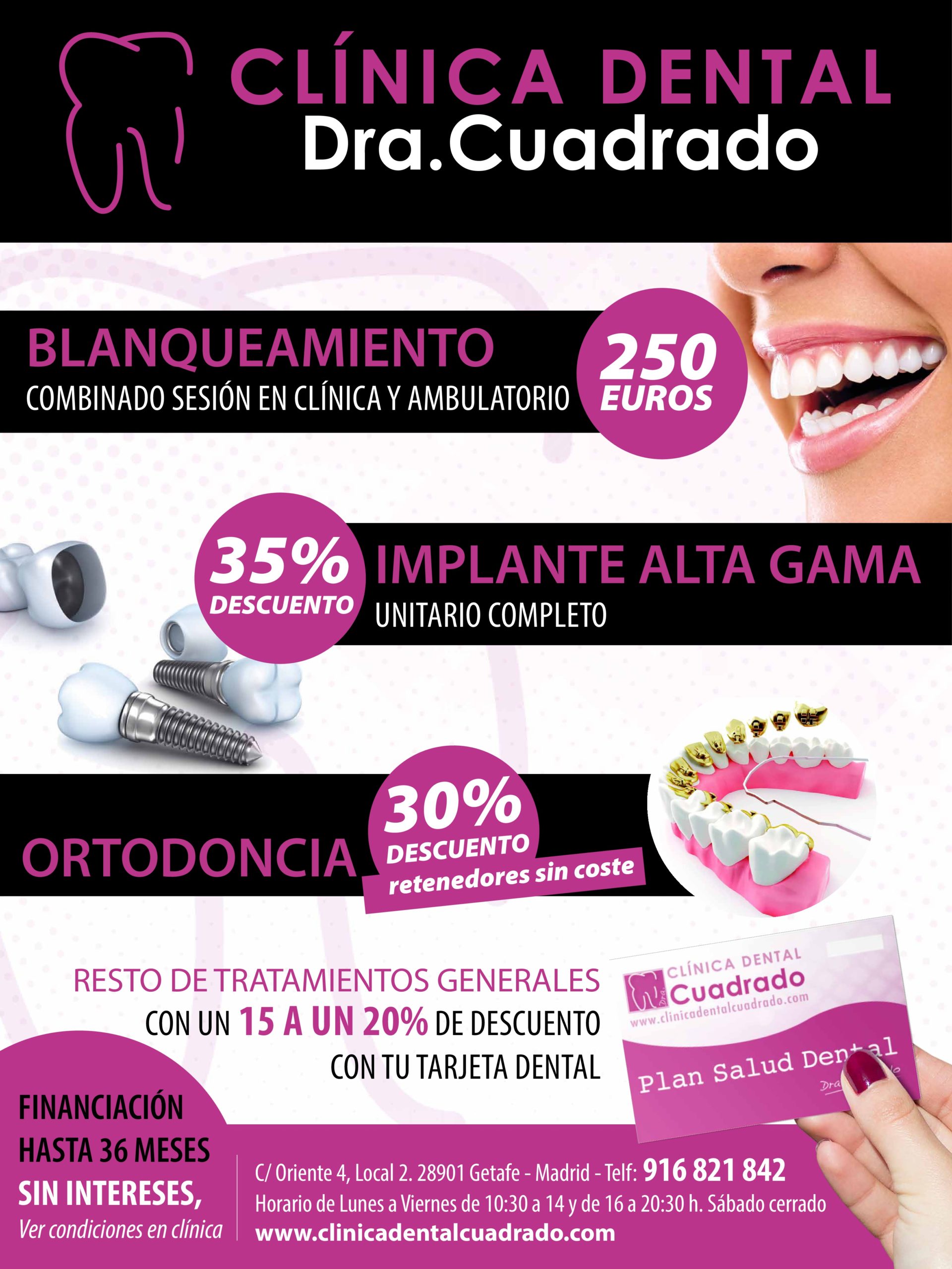 carillas dentales archivos - Clinica Dental Cuadrado