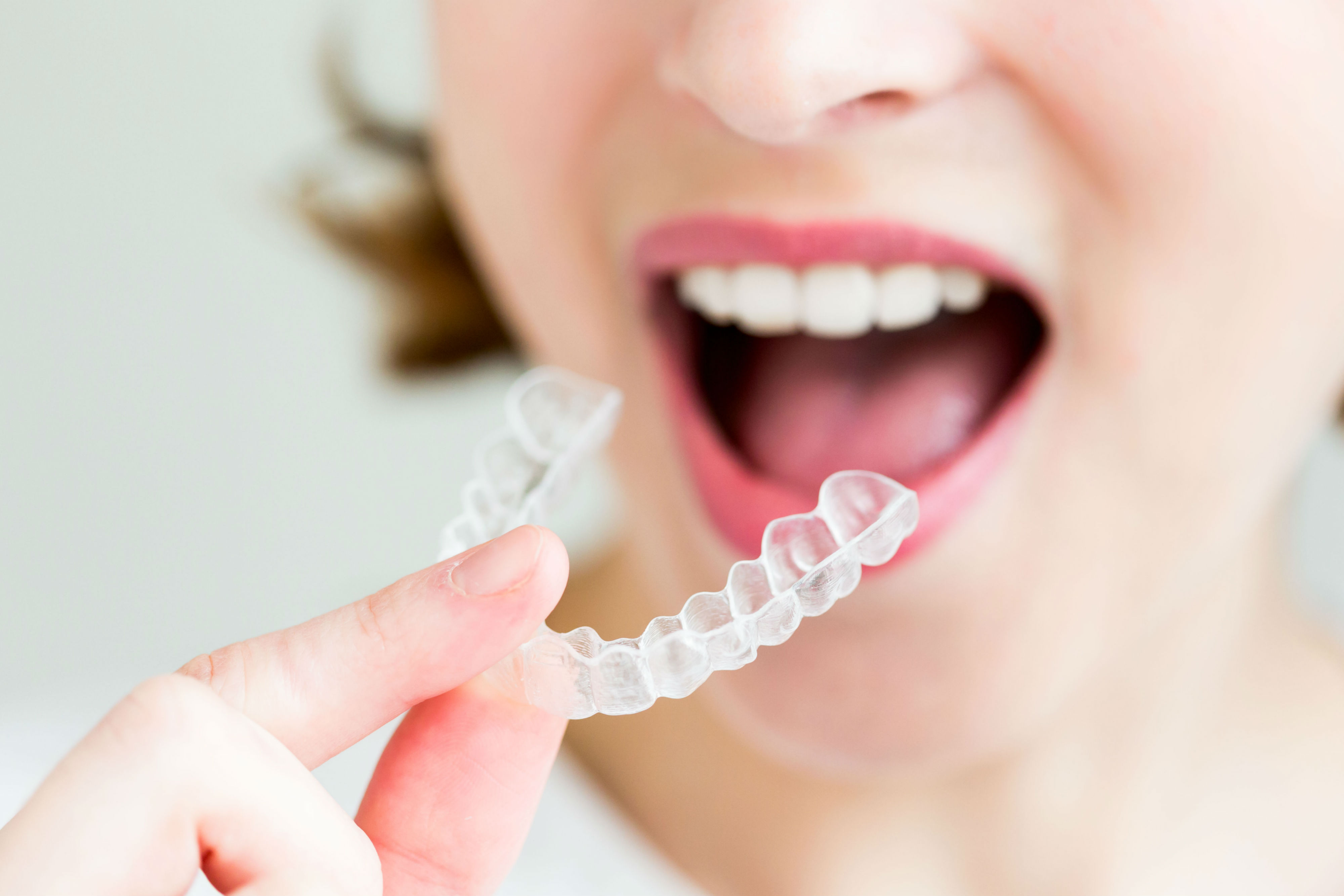 La ortodoncia Invisalign al mejor precio con las promociones de Clínica Dental Cuadrado de este mes de Febrero