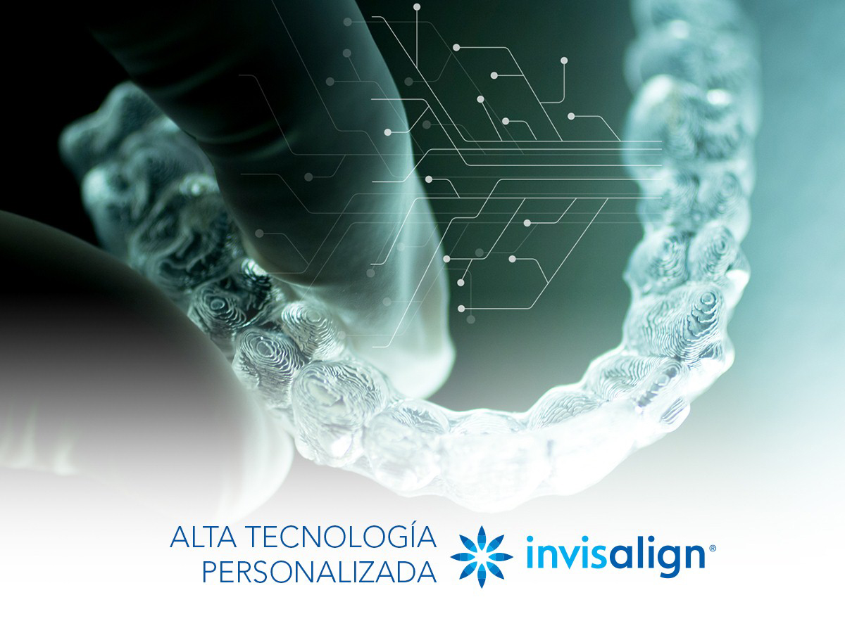 Lo último en tecnología para ortodoncias de la mano de Invisalign