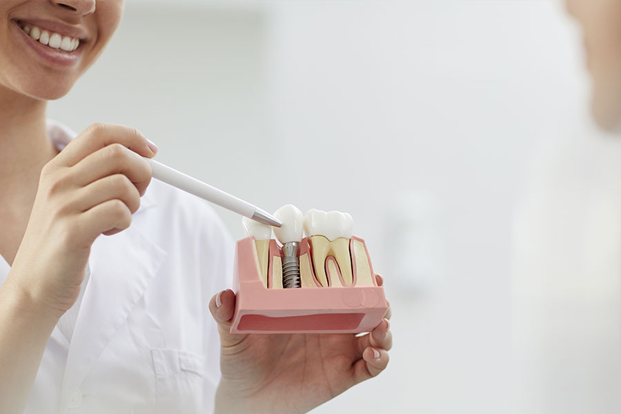 Análisis de los implantes dentales: cuáles son sus ventajas y cuáles son sus riesgos