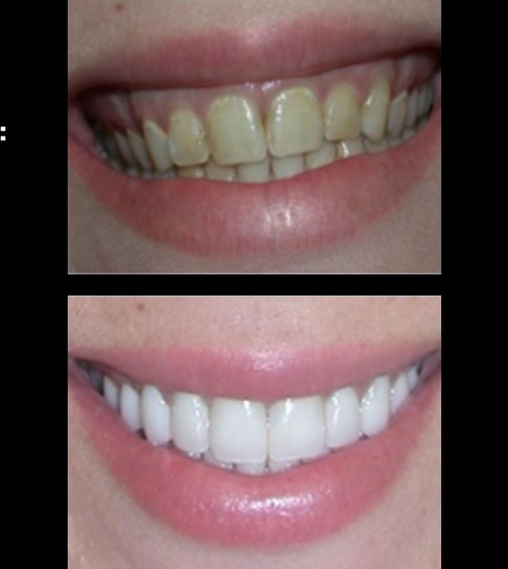 ¡Descubre “el Antes y el Después” que puedes conseguir con Clínica Dental Cuadrado!