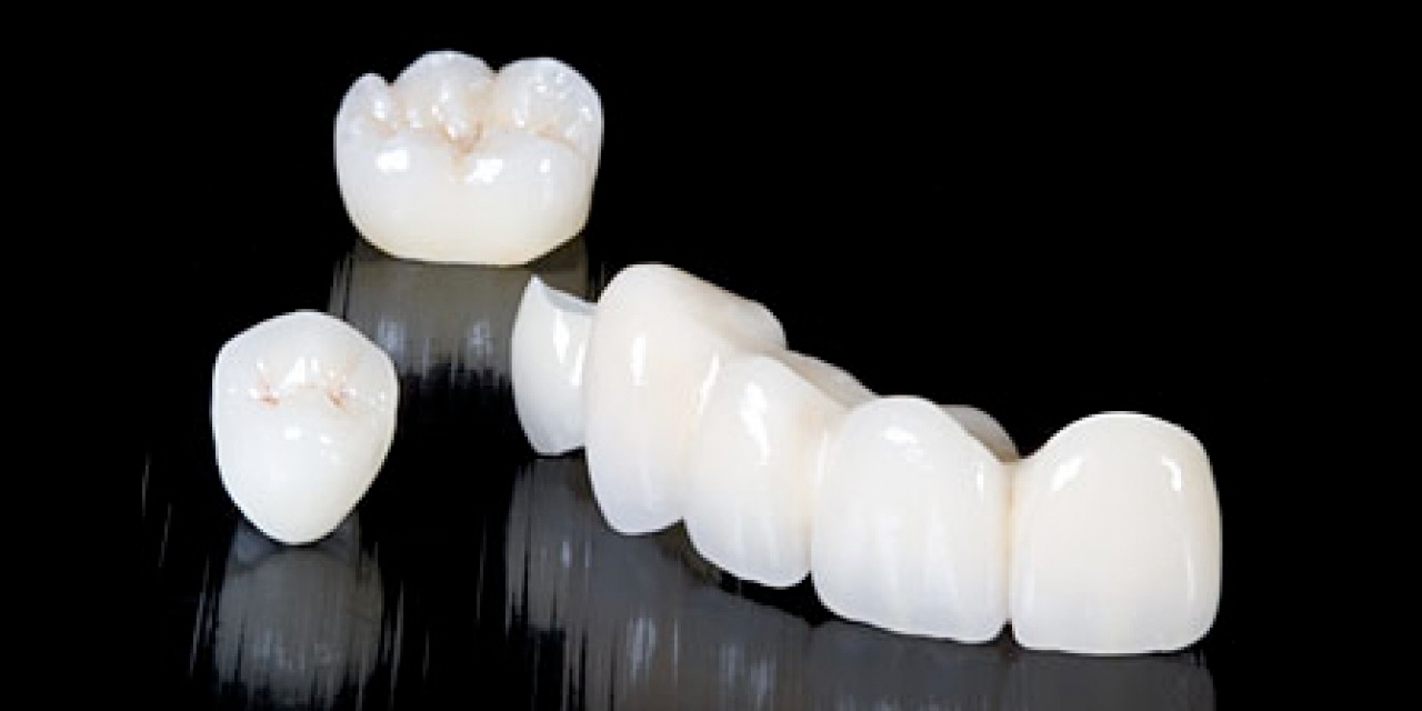 Zirconio el material del “futuro” para la odontología
