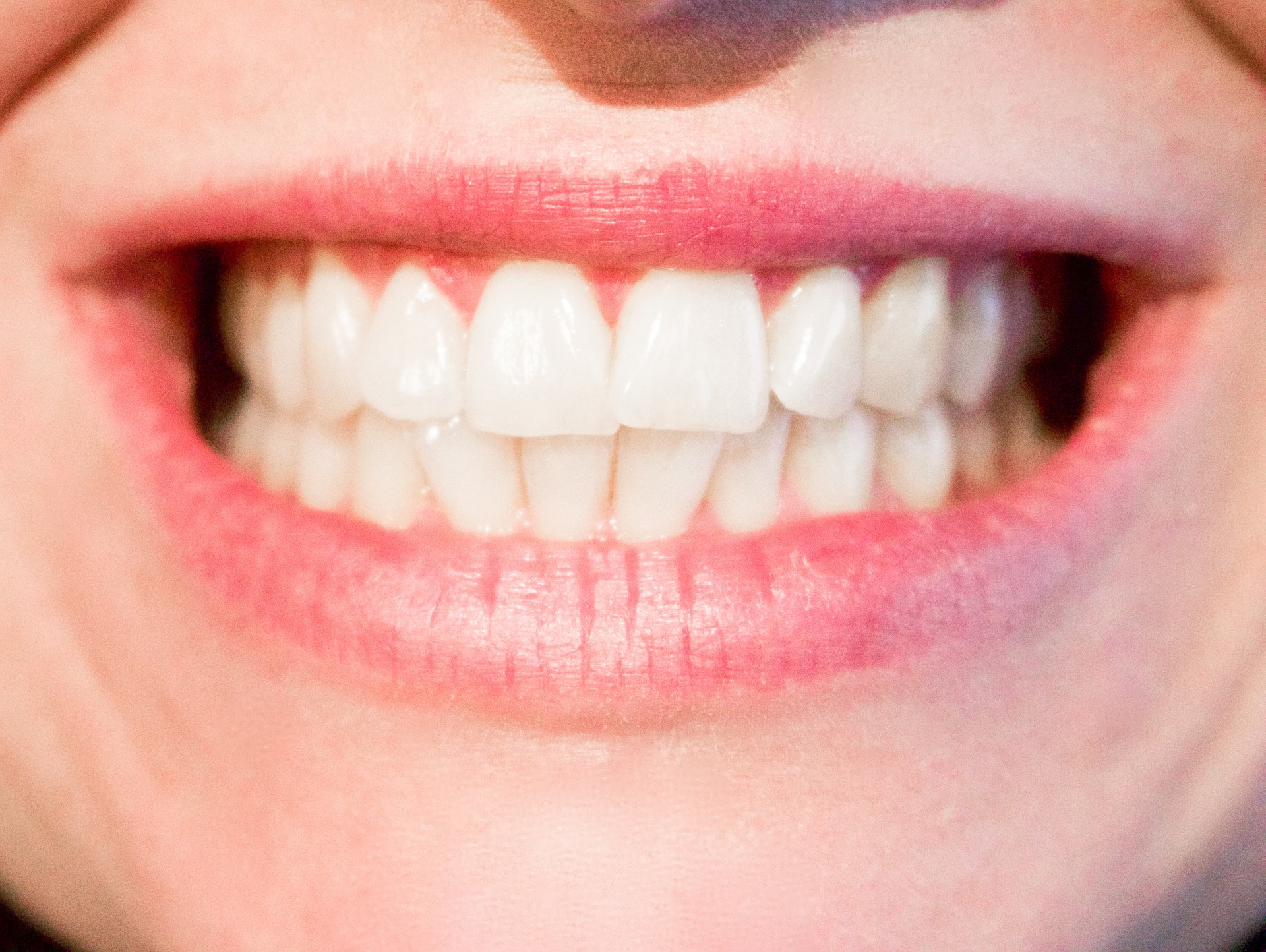 ¿Por qué merece la pena alinear tus dientes con una ortodoncia?