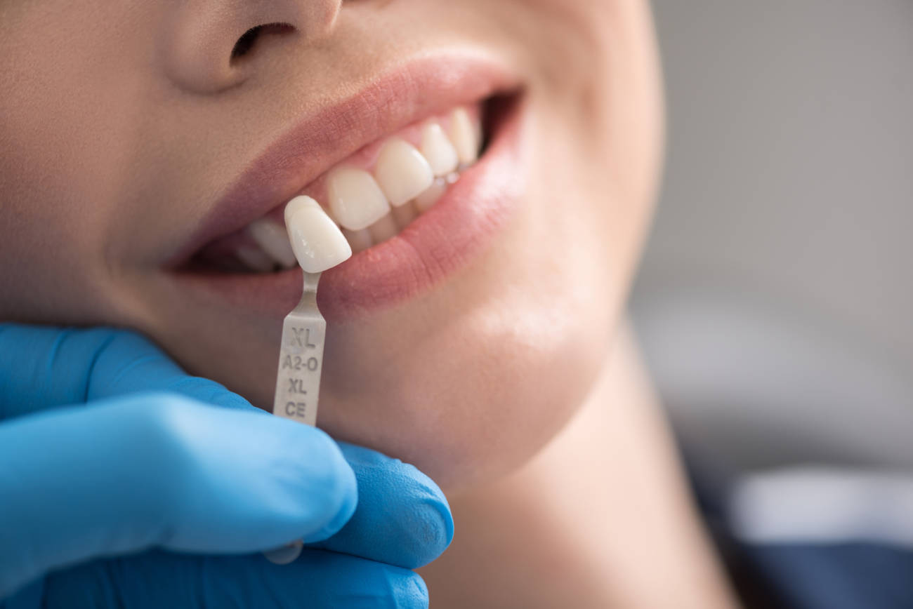 Las grandes ventajas que conlleva utilizar implantes dentales