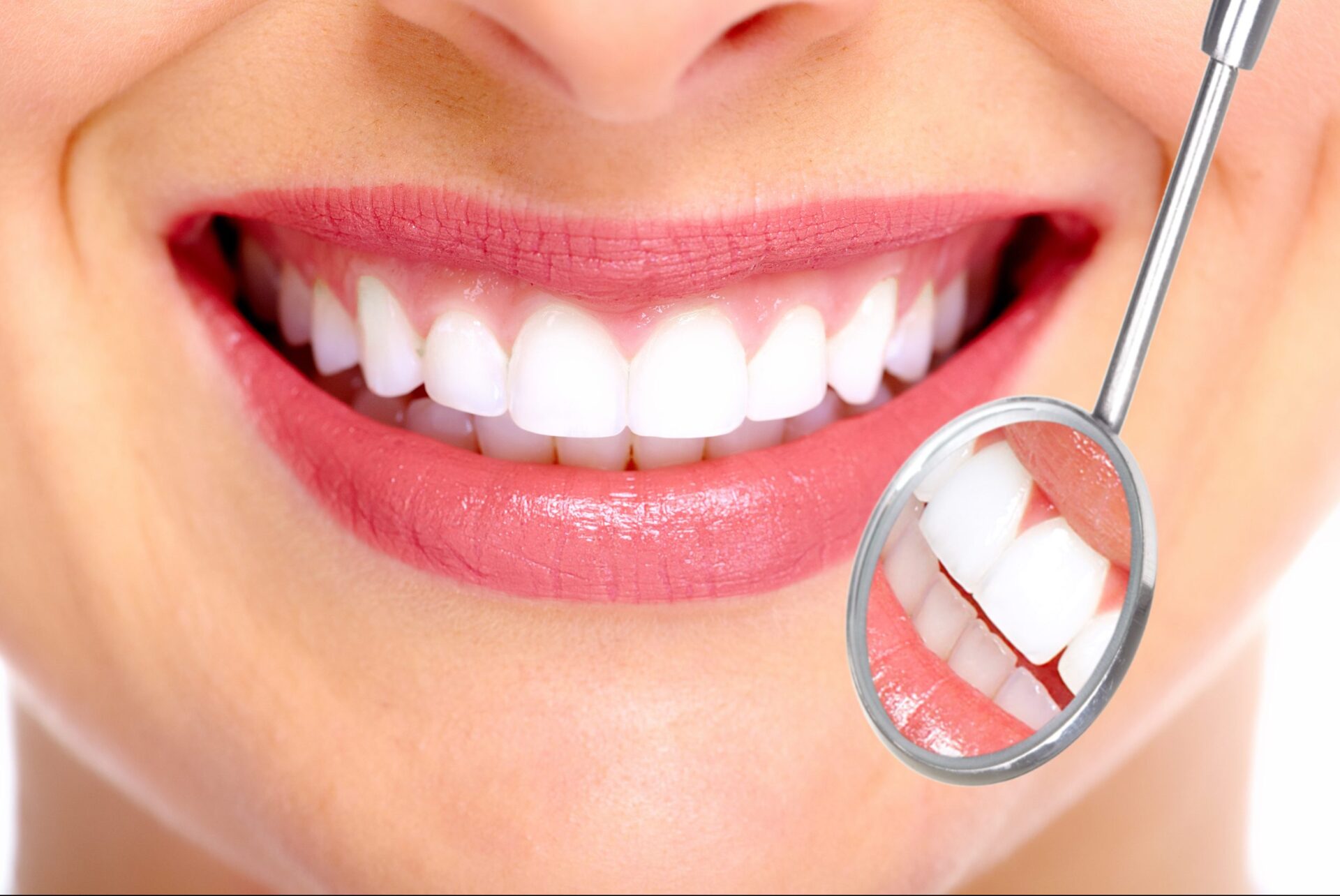 Mejora tu sonrisa con un tratamiento de blanqueamiento dental