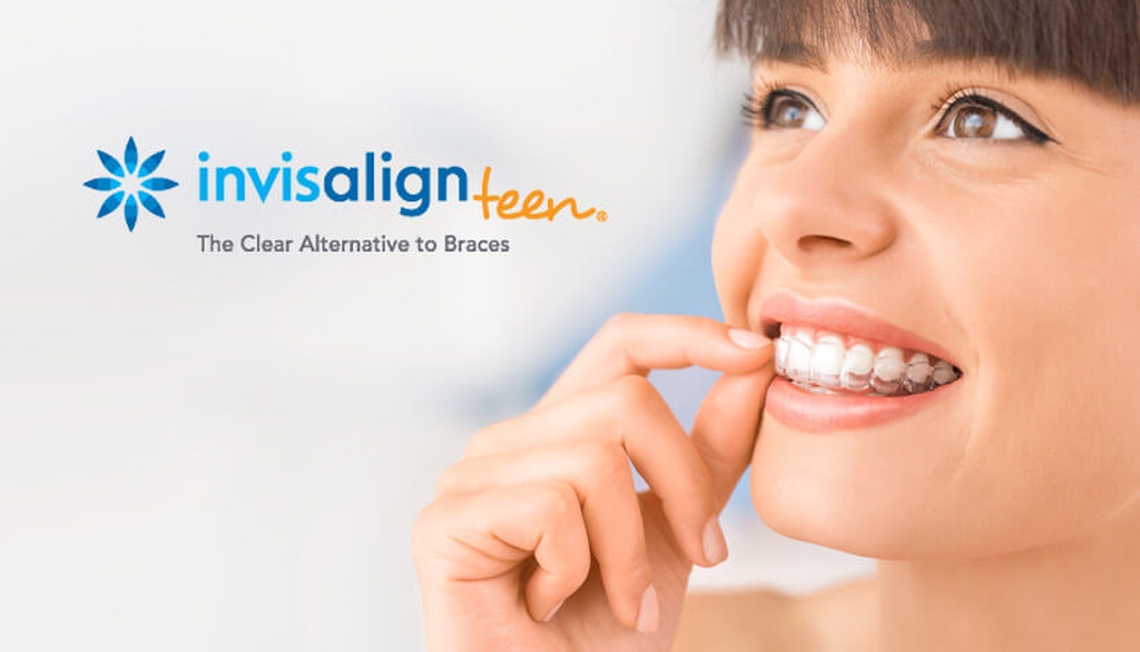 Invisalign Teen la “ortodoncia invisible” diseñada especialmente para jóvenes y adolescentes