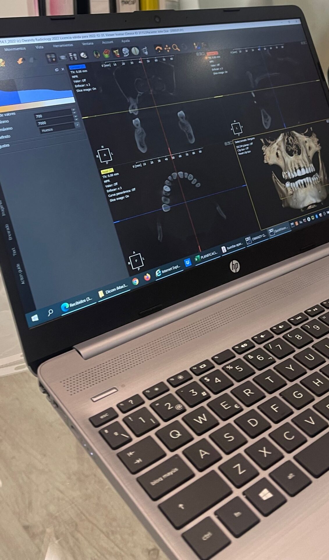 TAC dental 3D: un equipamiento lleno de cualidades