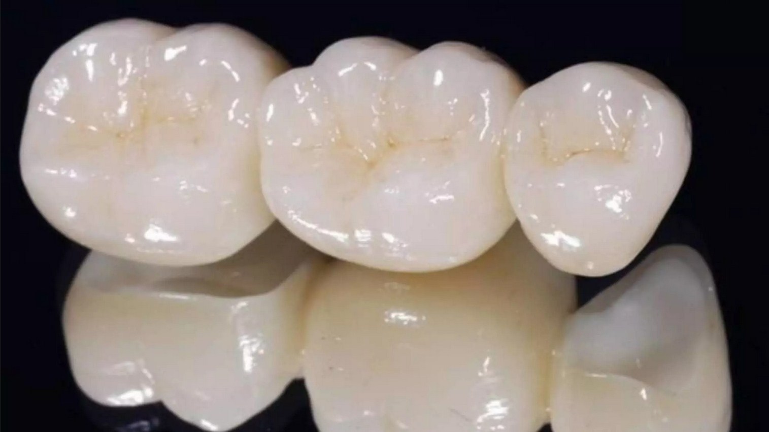 Zirconio, el material definitivo para elaborar prótesis dentales