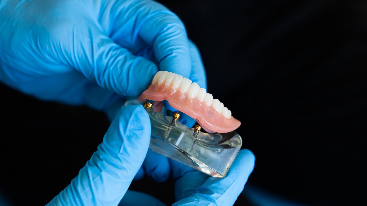 Prótesis híbrida, la solución dental que necesitas