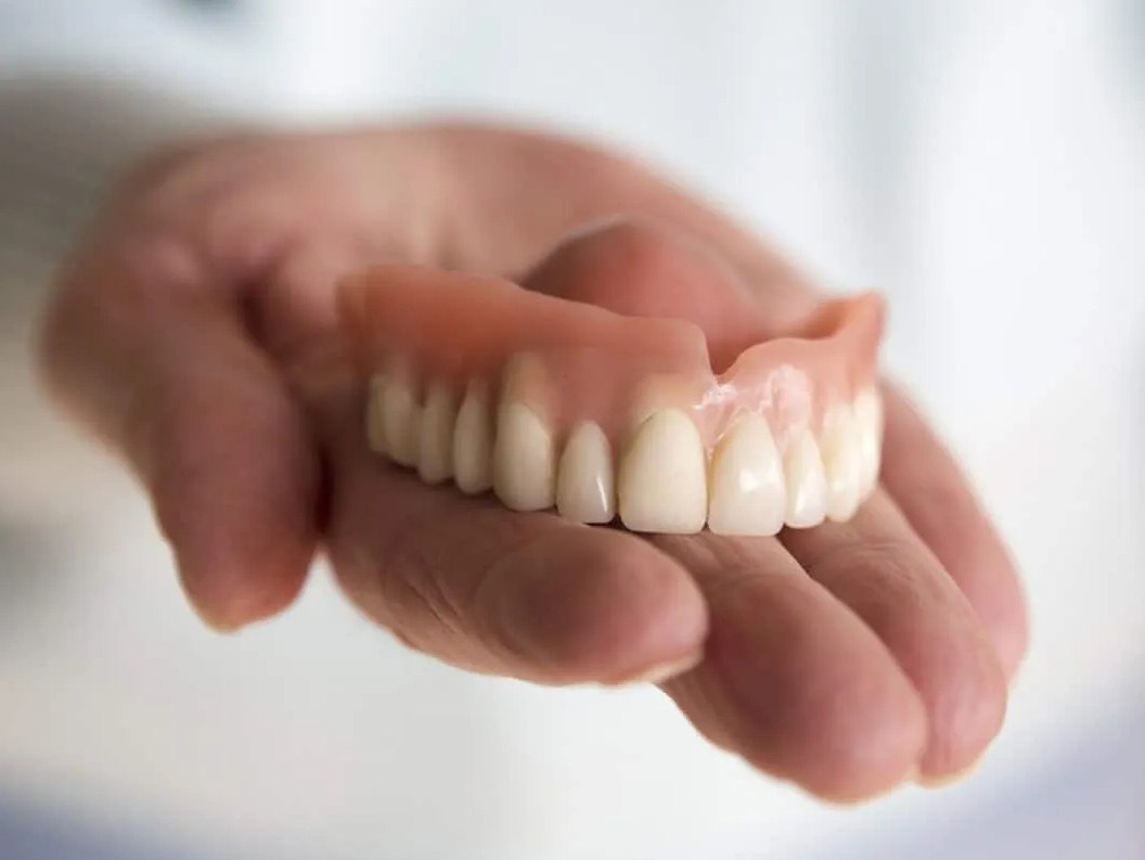 ¿Cómo es el proceso de colocación de una dentadura postiza?