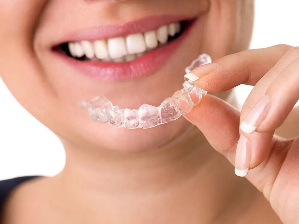 ¿Por qué Invisalign es un éxito en todo el mundo?