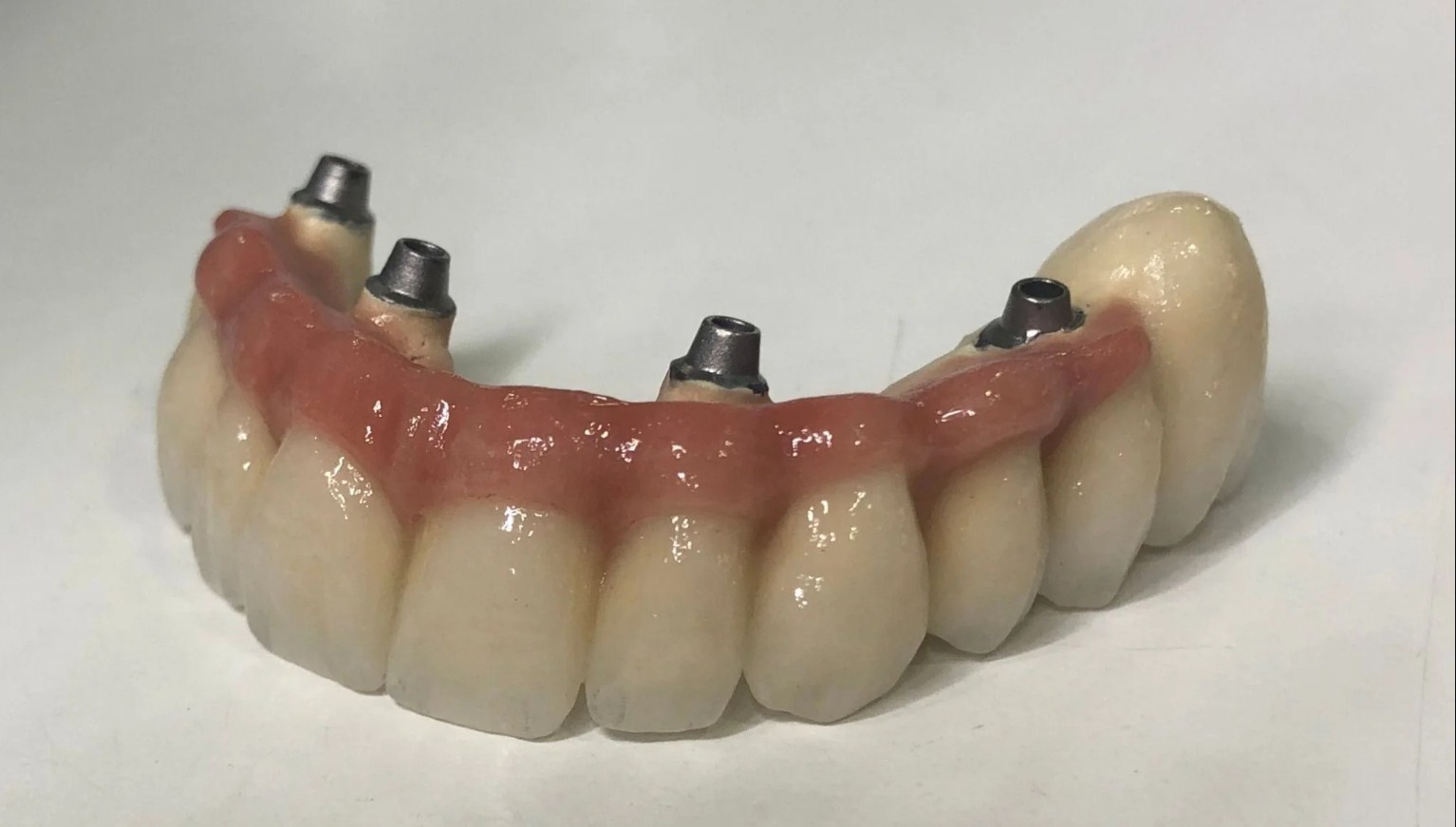 Rehabilita tu boca usando una prótesis dental híbrida