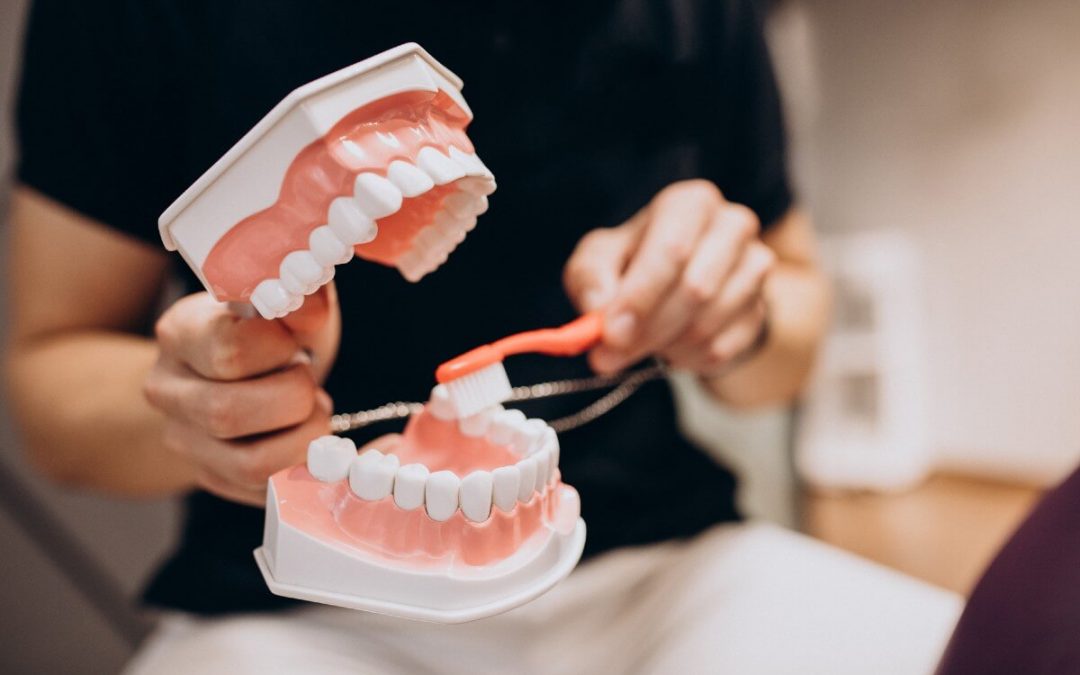 Higiene bucodental asociada al uso de una prótesis dental híbrida