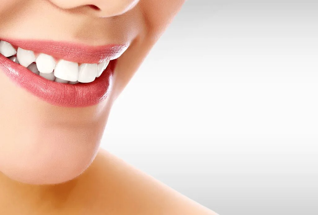 Cómo presumir de dientes blancos y de sonrisa perfecta con Carillas Lumineers
