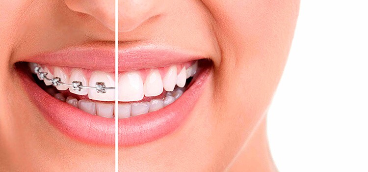 Mejora tu Salud Dental en la Clínica Dental Dra. Cuadrado