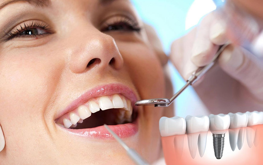 Clínica Dental especialista en Implantes Dentales en Getafe y Móstoles